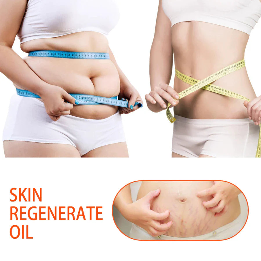 Bio-Oil Skincare Oil Stretch Marks Acne/Pimple Scar/Old/Scars Remover Removal Ageing Skin 200ML