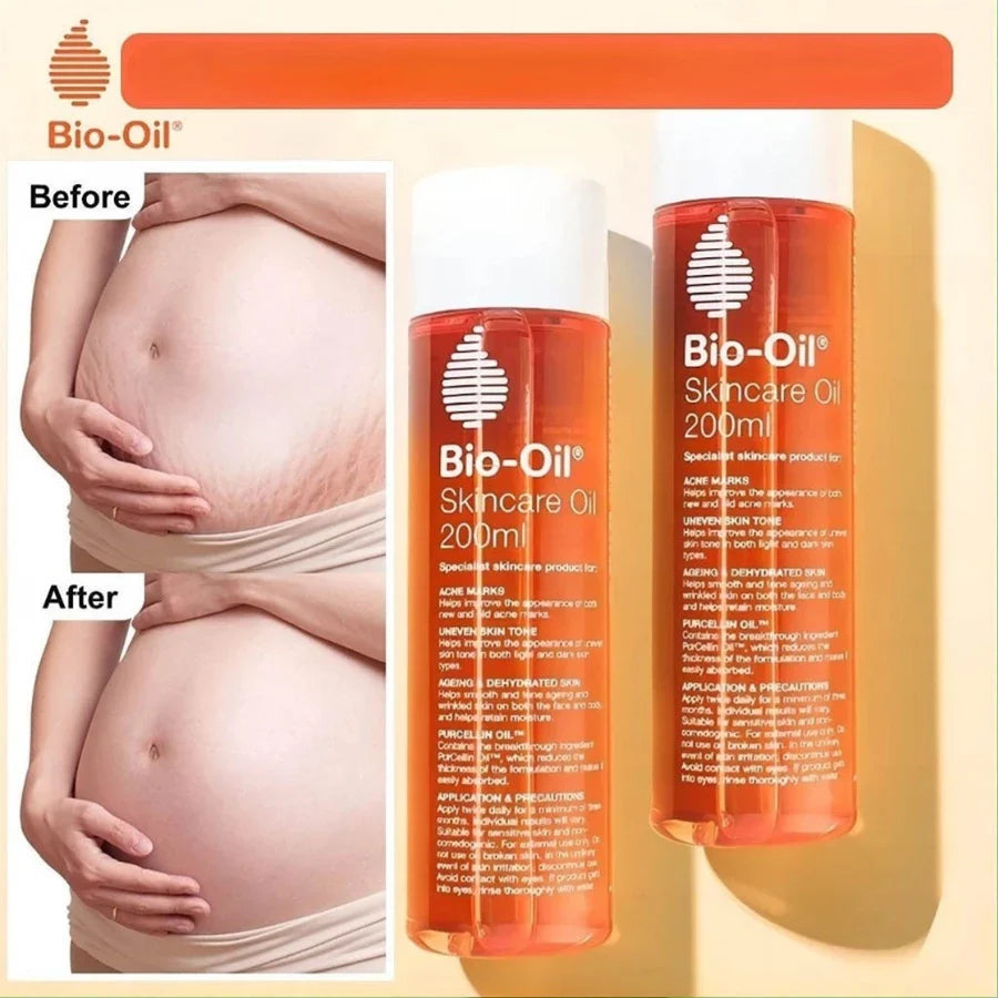 Bio-Oil Skincare Oil Stretch Marks Acne/Pimple Scar/Old/Scars Remover Removal Ageing Skin 200ML