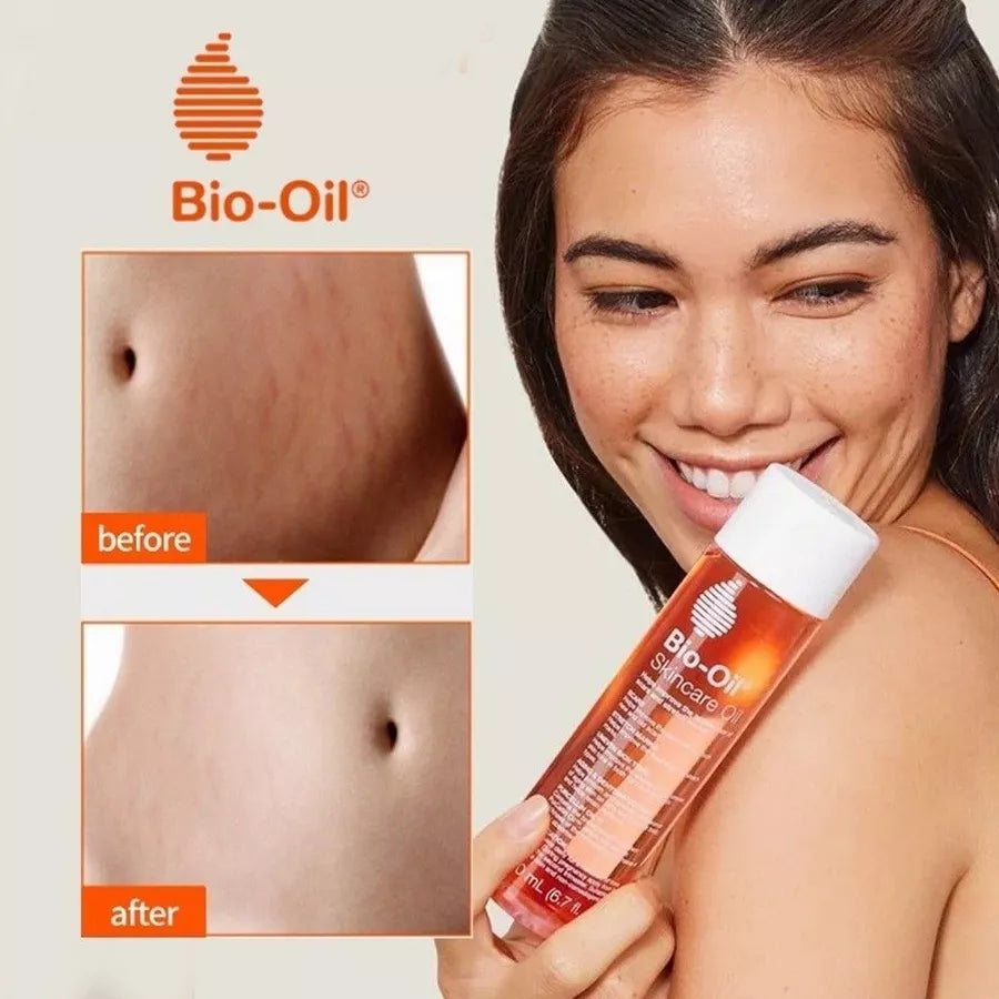 Bio-Oil Skincare Oil Stretch Marks Acne/Pimple Scar/Old/Scars Remover Removal Ageing Skin 200ML
