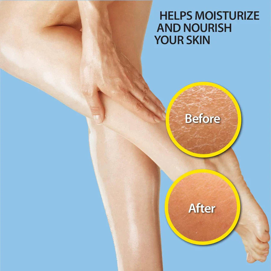 Bio-Oil Skincare Oil Stretch Marks Acne/Pimple Scar/Old/Scars Remover Removal Ageing Skin 200ML