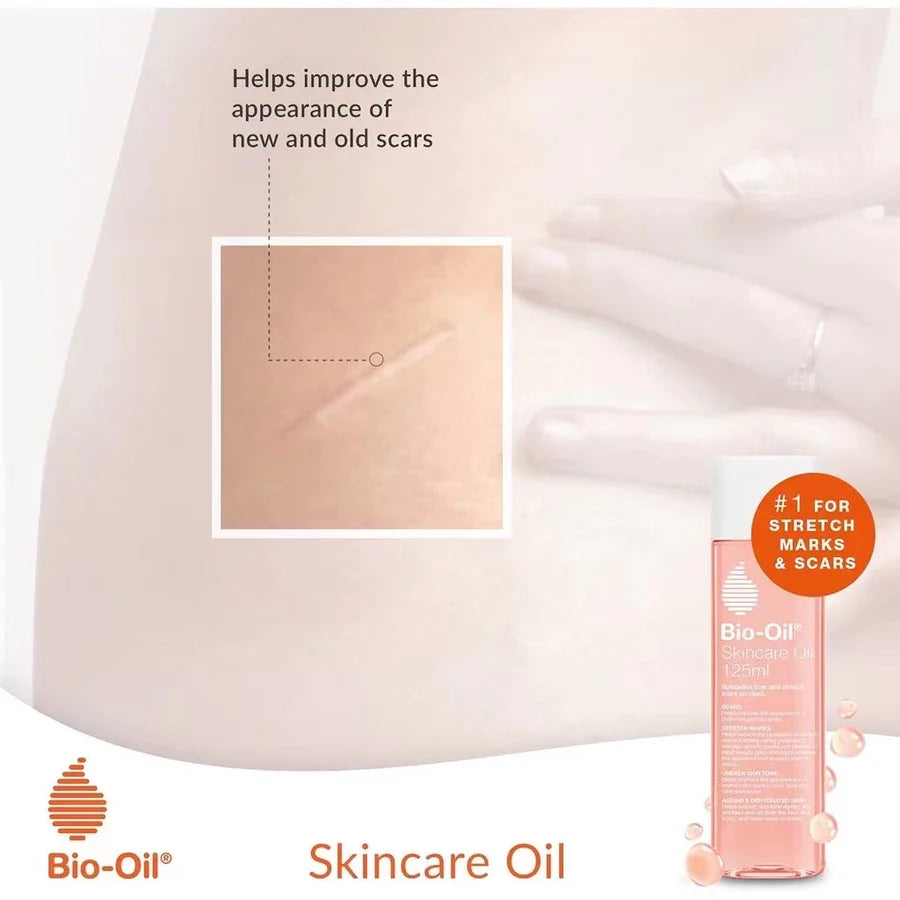 Bio-Oil Skincare Oil Stretch Marks Acne/Pimple Scar/Old/Scars Remover Removal Ageing Skin 200ML