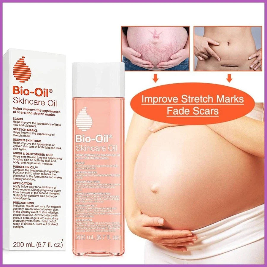 Bio-Oil Skincare Oil Stretch Marks Acne/Pimple Scar/Old/Scars Remover Removal Ageing Skin 200ML