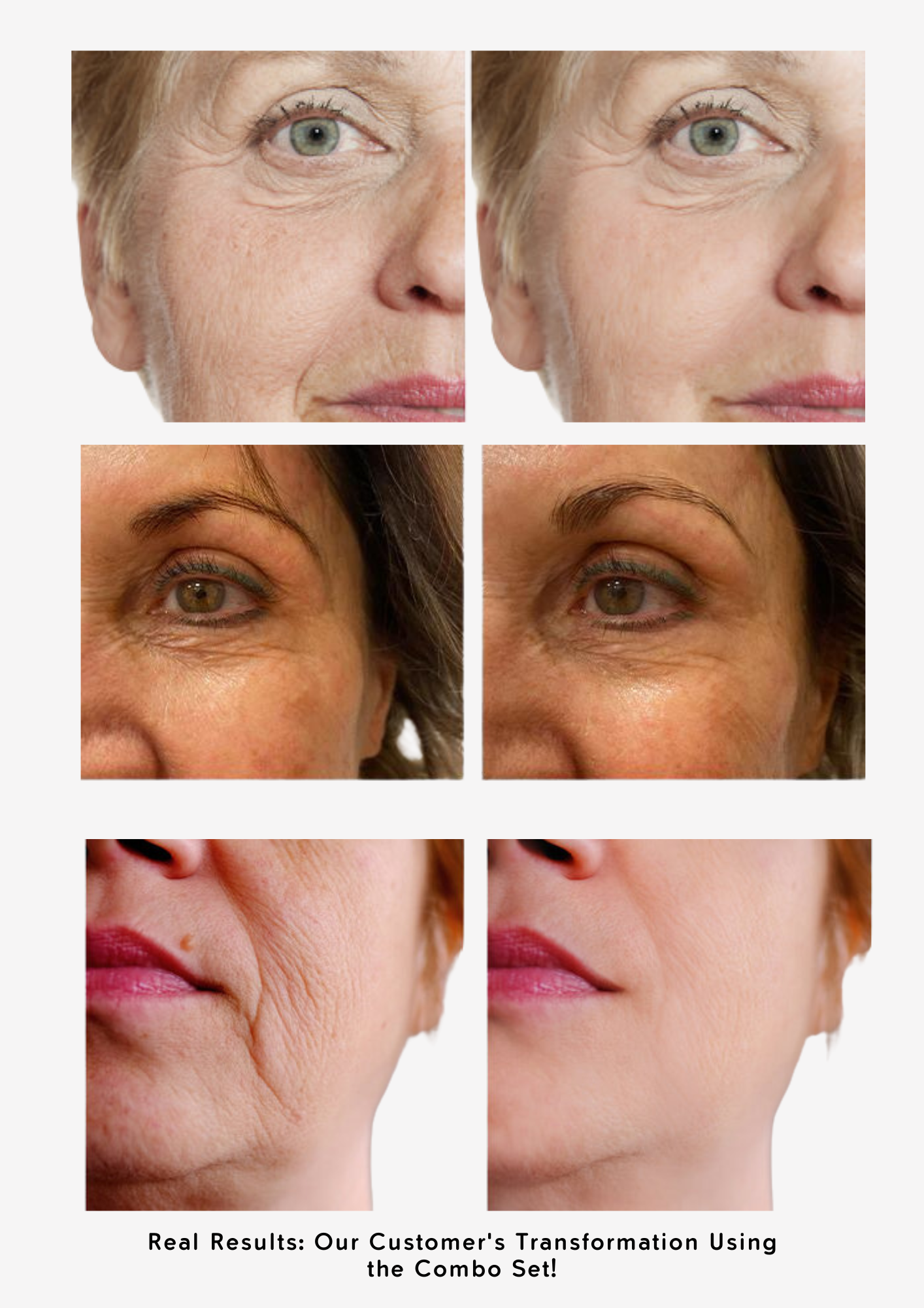 Youthful Skin Combo Set – Reduce Fine Lines & Wrinkles - Modarak Qatar