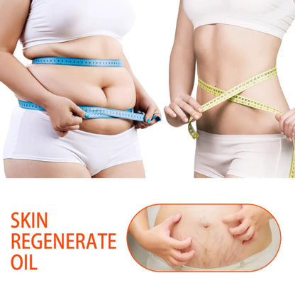 Bio-Oil Skincare Oil Stretch Marks Acne/Pimple Scar/Old/Scars Remover Removal Ageing Skin 200ML