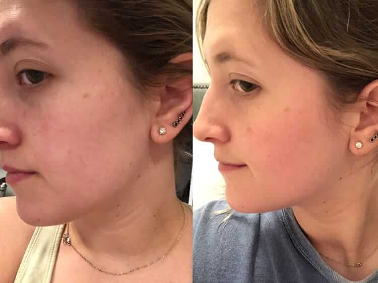 C E Ferulic® with 15% L-Ascorbic Acid