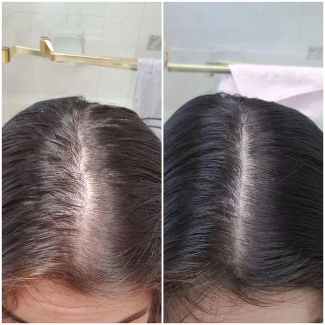 Rogaine for Women - Hair Regrowth 5% Minoxidil Foam 2 Month Supply - Modarak UAE